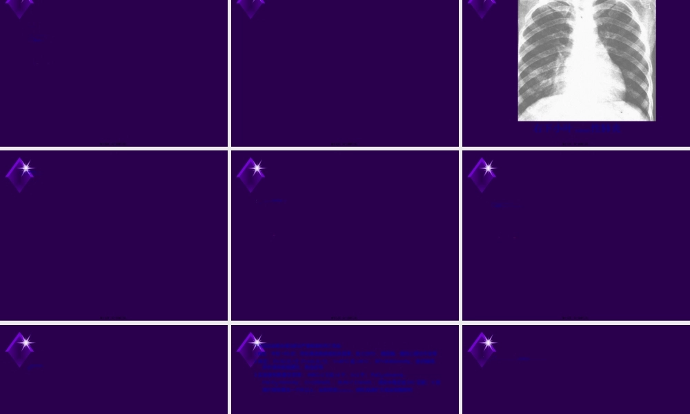 2022年医学专题—肺炎-肺脓肿(1).ppt