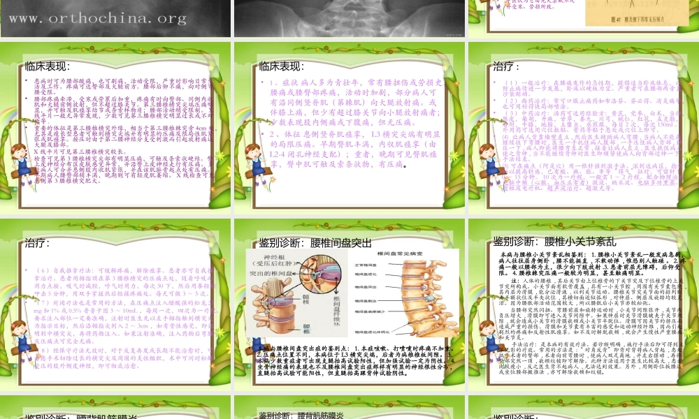 腰3横突综合症1.ppt