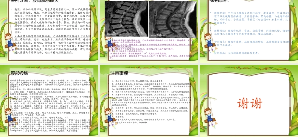 腰3横突综合症1.ppt