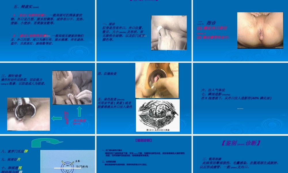 2022年医学专题—第十章--肛管直肠瘘(1).ppt