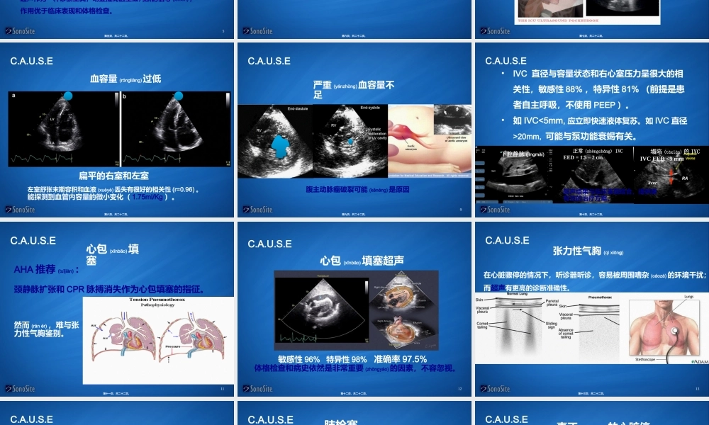 2022年医学专题—ICU-超声在心脏骤停应用(1).ppt