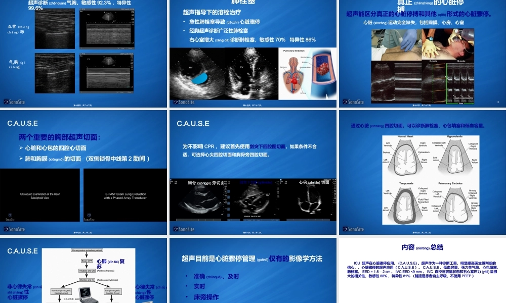 2022年医学专题—ICU-超声在心脏骤停应用(1).ppt