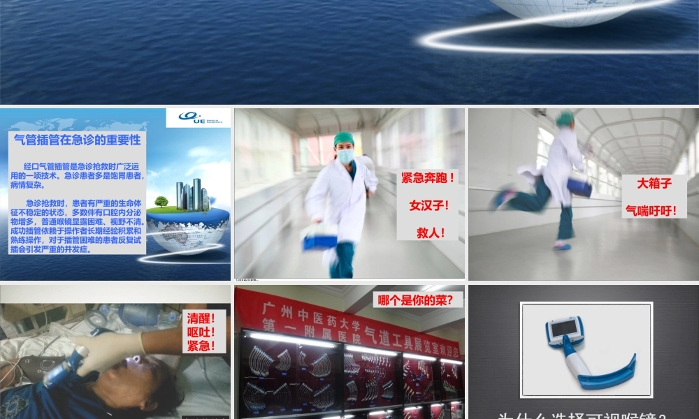 可视喉镜在急诊中的应用.ppt