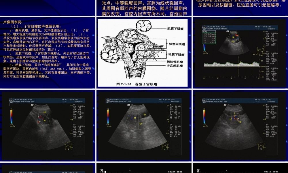 妇科超声检查.pptx