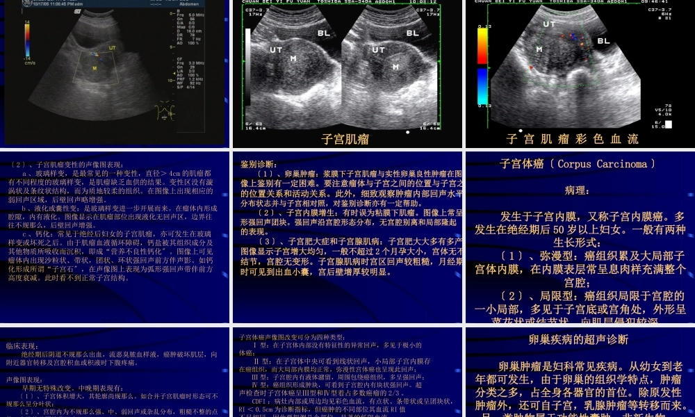 妇科超声检查.pptx