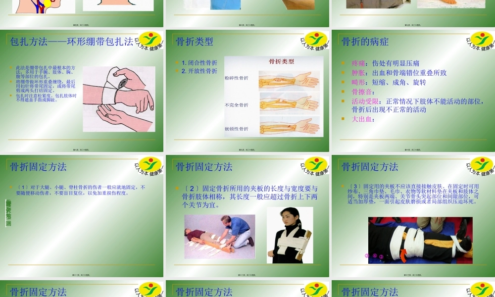 四年级急救的止血、包扎、骨折固定和搬运技术.pptx