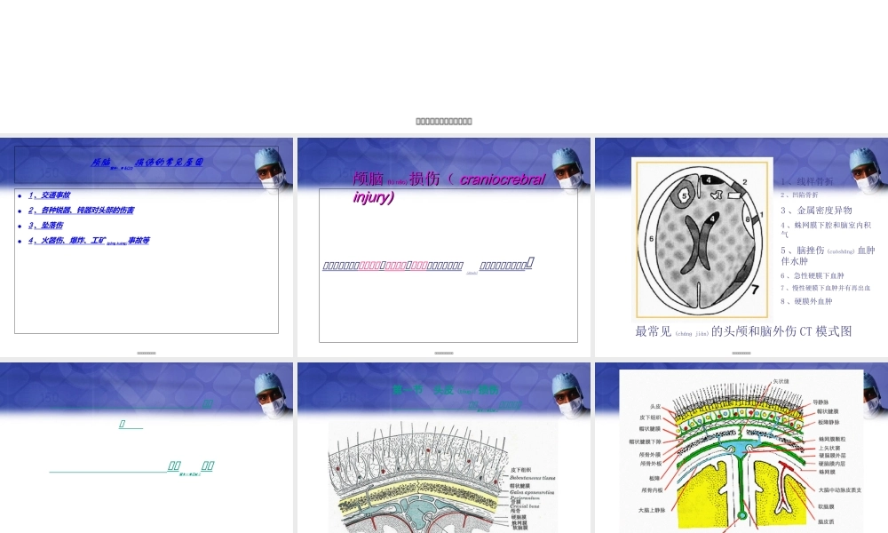 2022年医学专题—《颅脑损伤1》-PPT文档(1).ppt