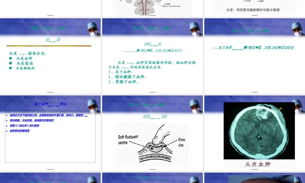 2022年医学专题—《颅脑损伤1》-PPT文档(1).ppt