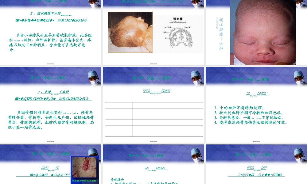 2022年医学专题—《颅脑损伤1》-PPT文档(1).ppt