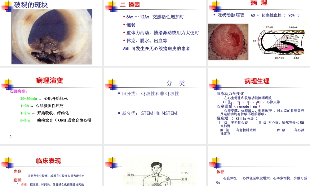 急性心肌梗死教学查房.ppt