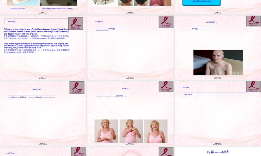 2022年医学专题—乳腺癌演讲.ppt