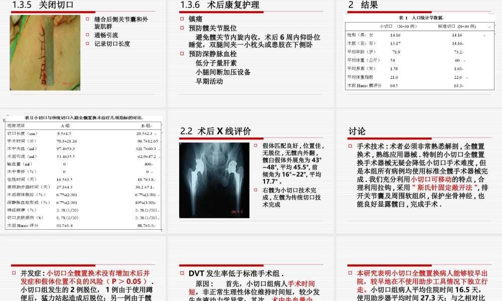 沿股骨颈后外侧小切口全髋关节置换术疗效分析.ppt