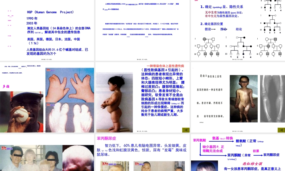 2022年医学专题—人类遗传病共张PPT.ppt