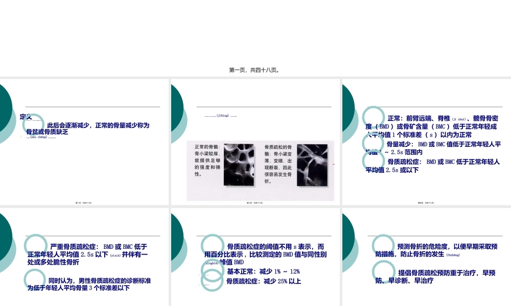 2022年医学专题—双能X线吸收法骨密度测定影响因素初探.ppt