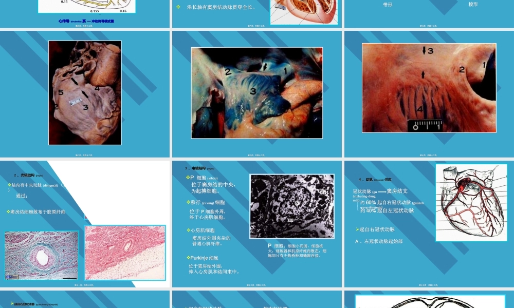 2022年医学专题—心脏传导系统剖析.ppt