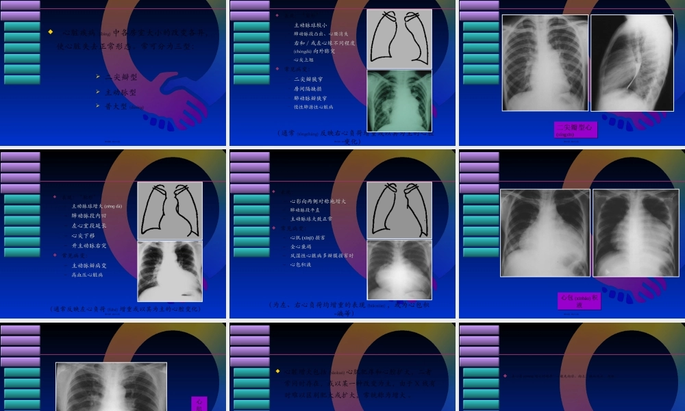 2022年医学专题—心脏大血管基本病变的X线表现.ppt