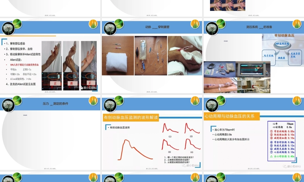 2022年医学专题—有创动脉压监测波形分析.ppt