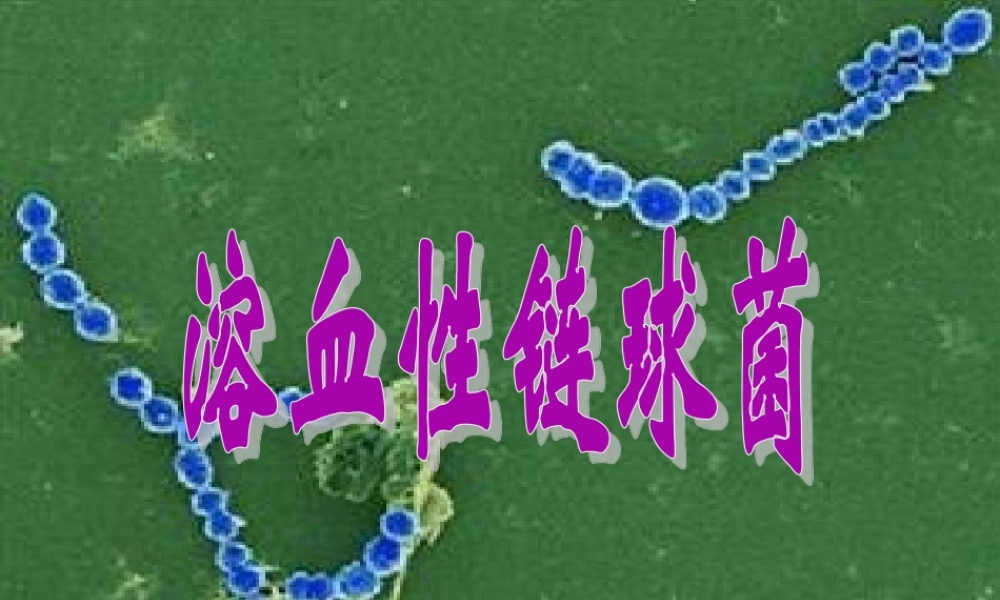 2022年医学专题—溶血性链球菌.ppt