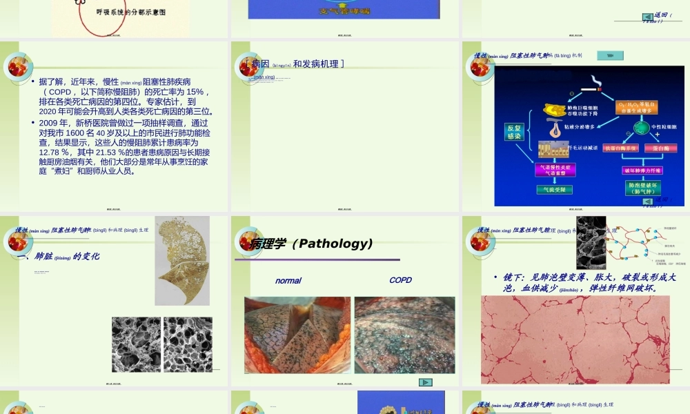 2022年医学专题—第四节二、-阻塞性肺气肿、肺源性心脏病.ppt