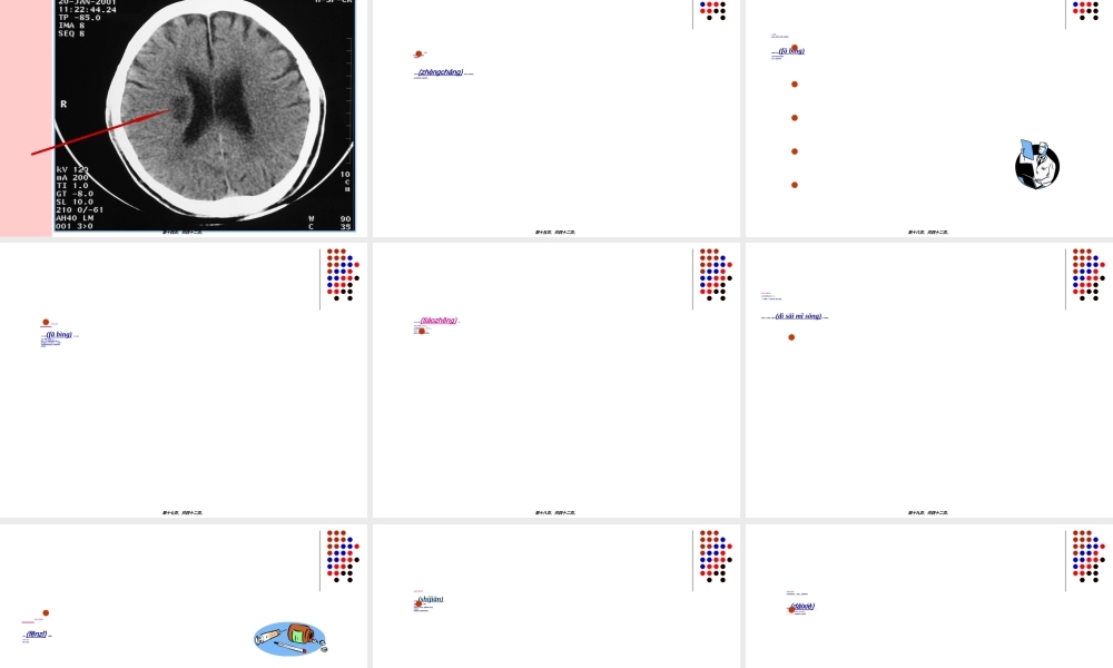 2022年医学专题—脑梗死、脑栓塞教学大全讲解.ppt