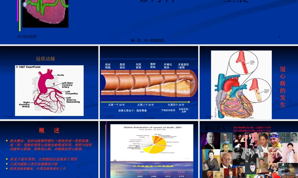 冠状动脉粥样硬化性心脏病2013第八版.pptx