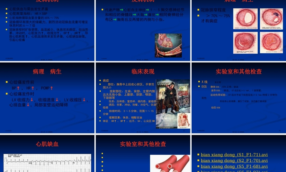 冠状动脉粥样硬化性心脏病2013第八版.pptx