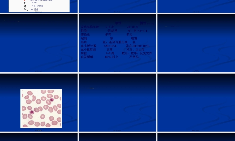 2022年医学专题—第三节-特发性血小板减少性紫癜.ppt