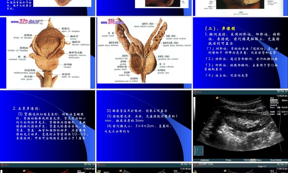 8.泌尿系统及前列腺超声检查.ppt