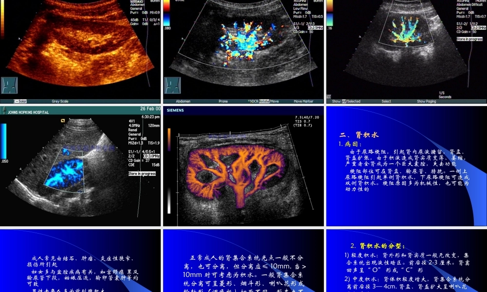 8.泌尿系统及前列腺超声检查.ppt