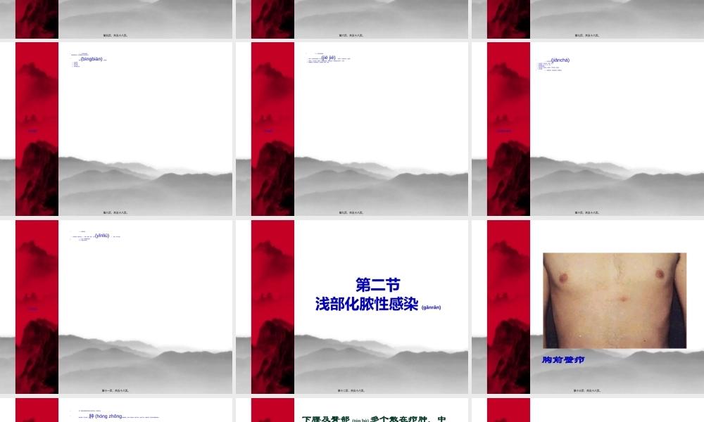 2022年医学专题—外科感染--戴斯斯.ppt