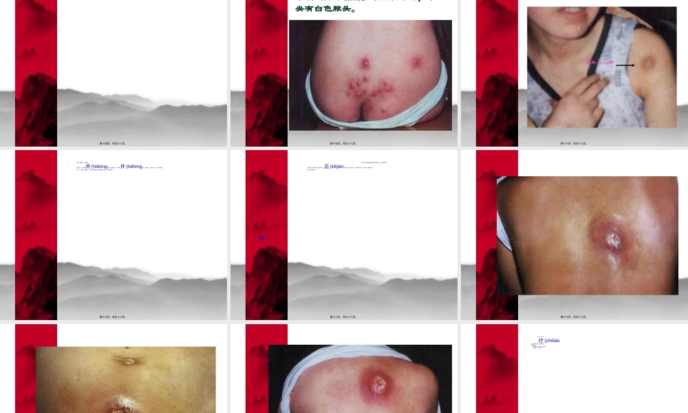 2022年医学专题—外科感染--戴斯斯.ppt