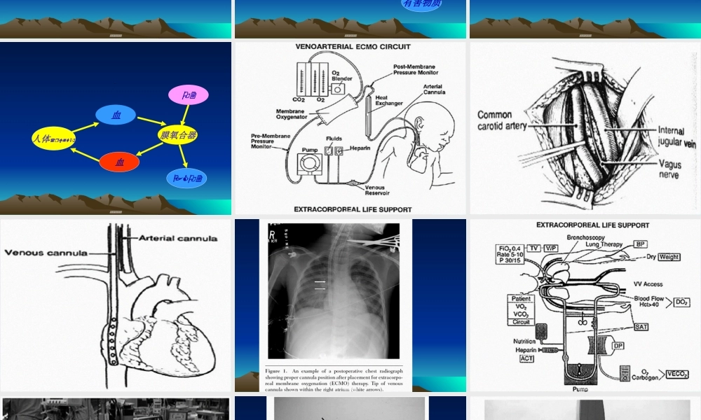 2022年医学专题—多脏器功能障碍杭州1008.ppt