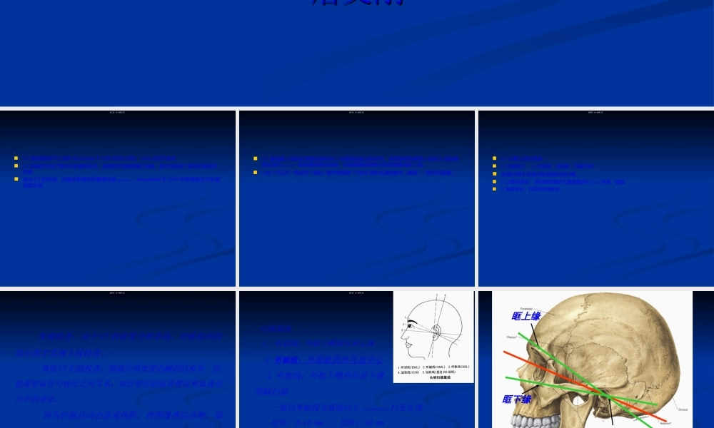 2022年医学专题—头颅CT读片.ppt