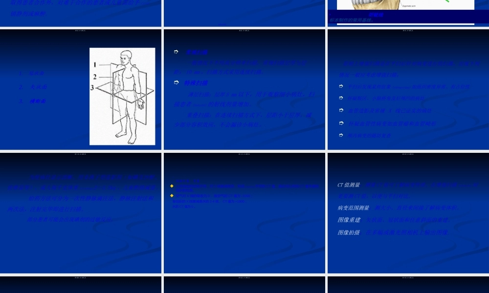 2022年医学专题—头颅CT读片.ppt