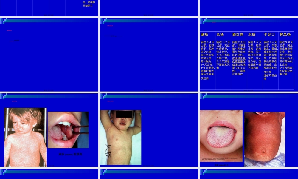 2022年医学专题—出疹性传染病(1).ppt