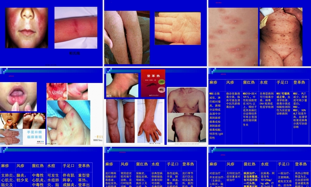 2022年医学专题—出疹性传染病(1).ppt