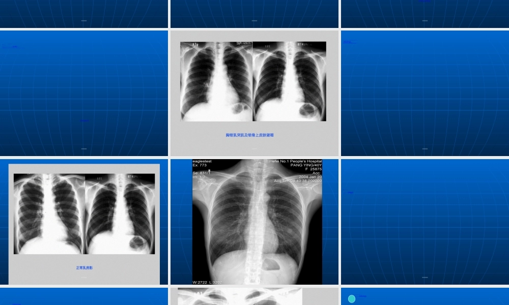 2022年医学专题—第三篇--呼吸系统1.ppt