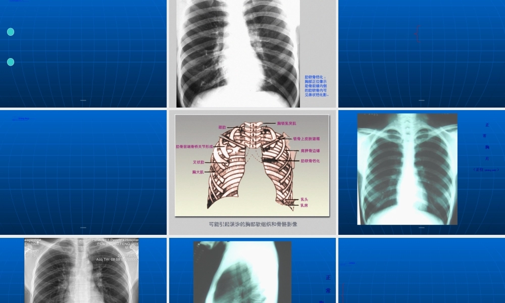2022年医学专题—第三篇--呼吸系统1.ppt