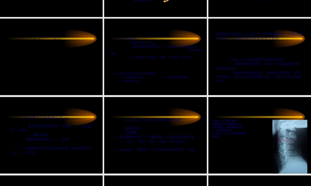 2022年医学专题—第六节-颈椎病.ppt