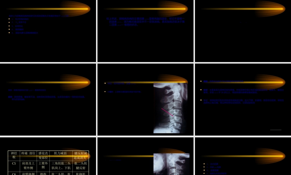 2022年医学专题—第六节-颈椎病.ppt