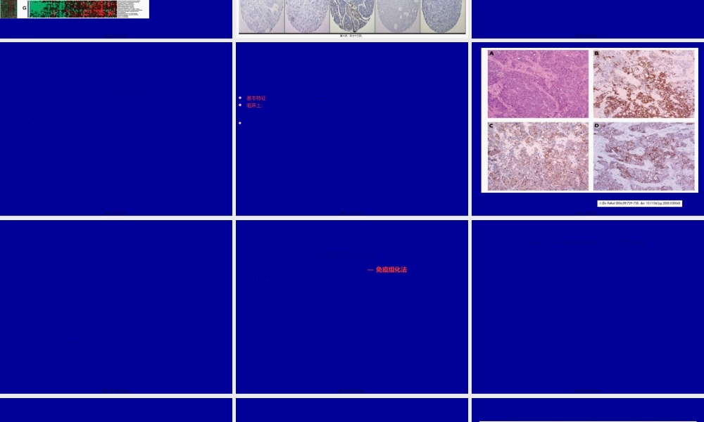 2022年医学专题—余之刚(山东大学第二医院乳腺外科)基底细胞样型乳腺癌.ppt