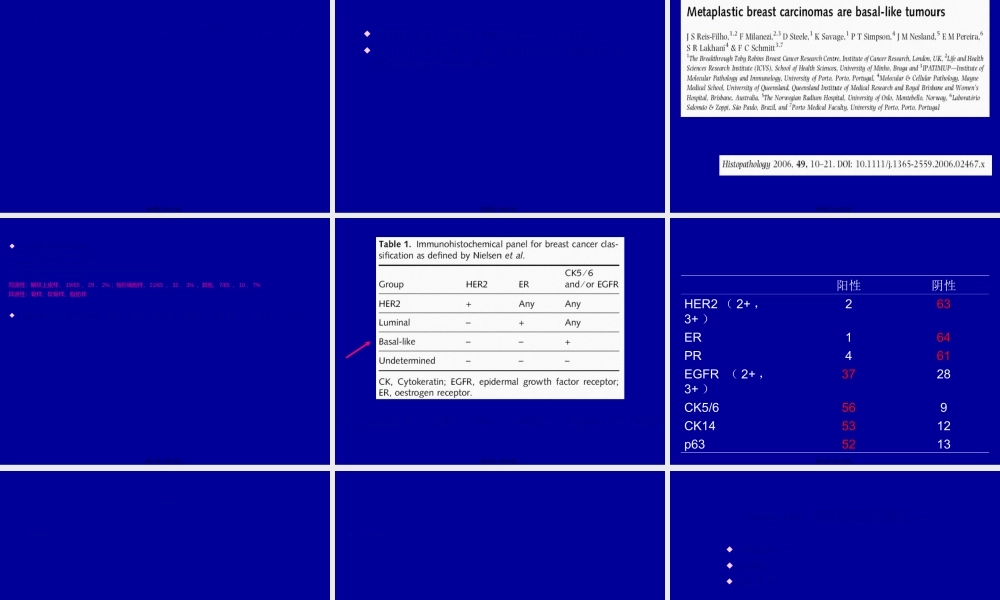 2022年医学专题—余之刚(山东大学第二医院乳腺外科)基底细胞样型乳腺癌.ppt