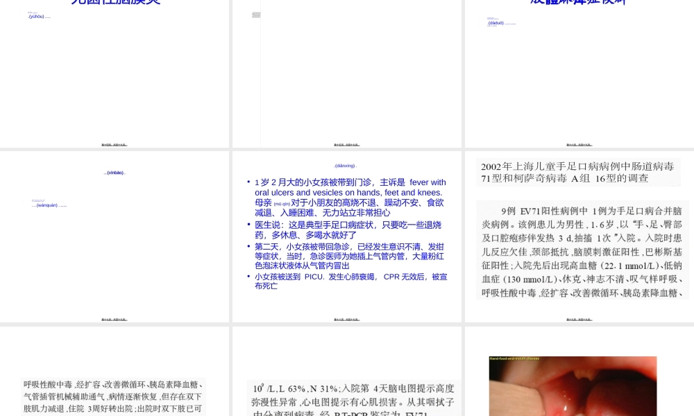 2022年医学专题—手足口病的相关知识.ppt