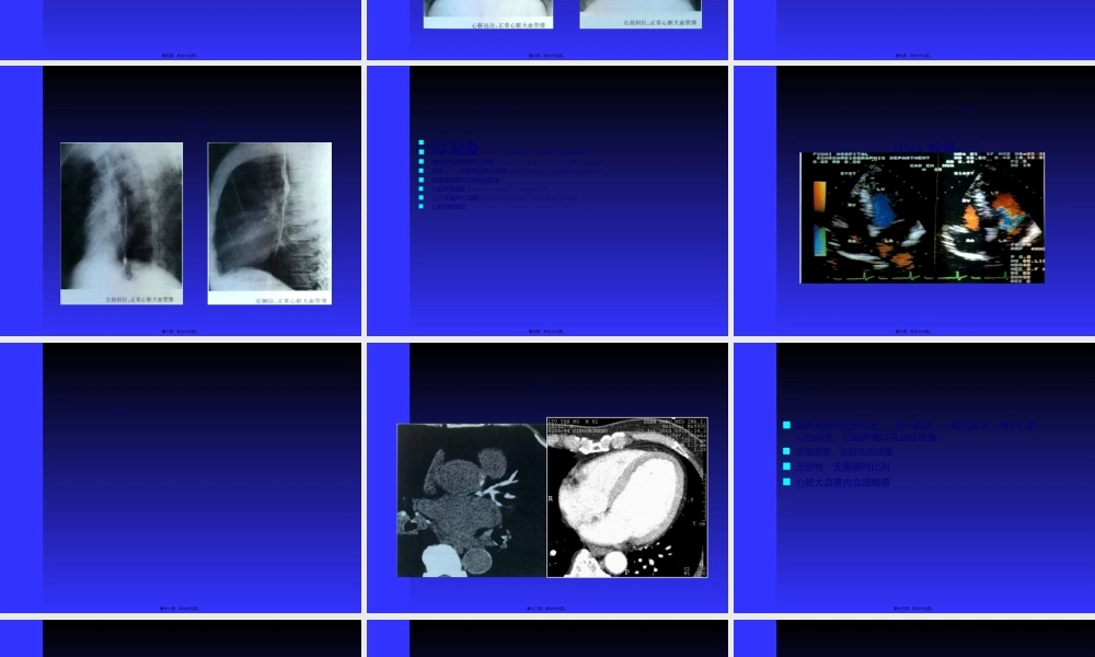 2022年医学专题—心脏与大血管(李传亭).ppt