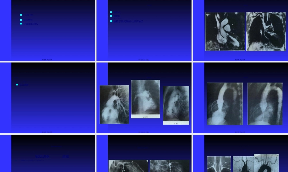 2022年医学专题—心脏与大血管(李传亭).ppt