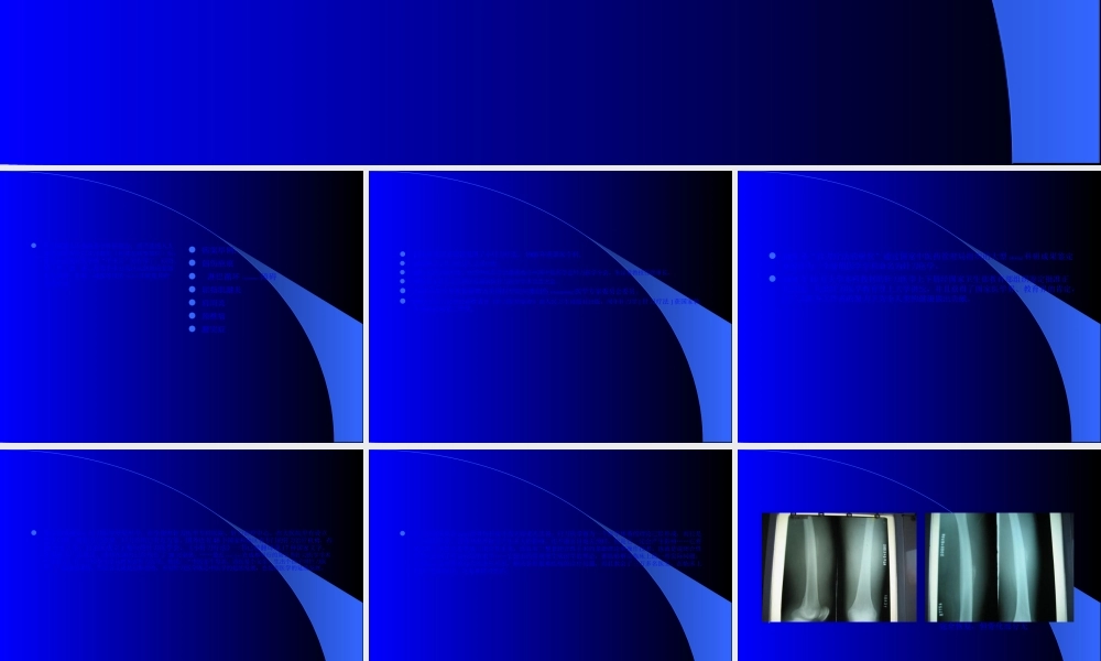 2022年医学专题—最新膝关节骨性关炎诊疗分析-PPT文档.ppt