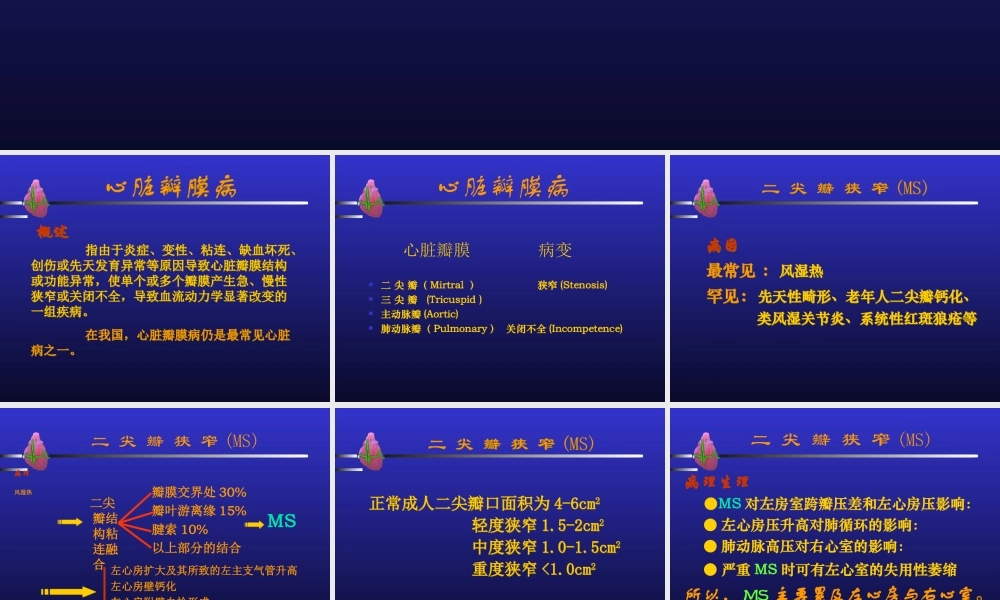 心瓣膜病与心内膜炎多媒体.ppt