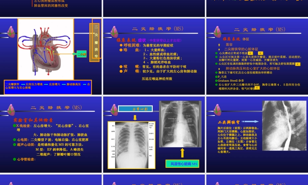 心瓣膜病与心内膜炎多媒体.ppt