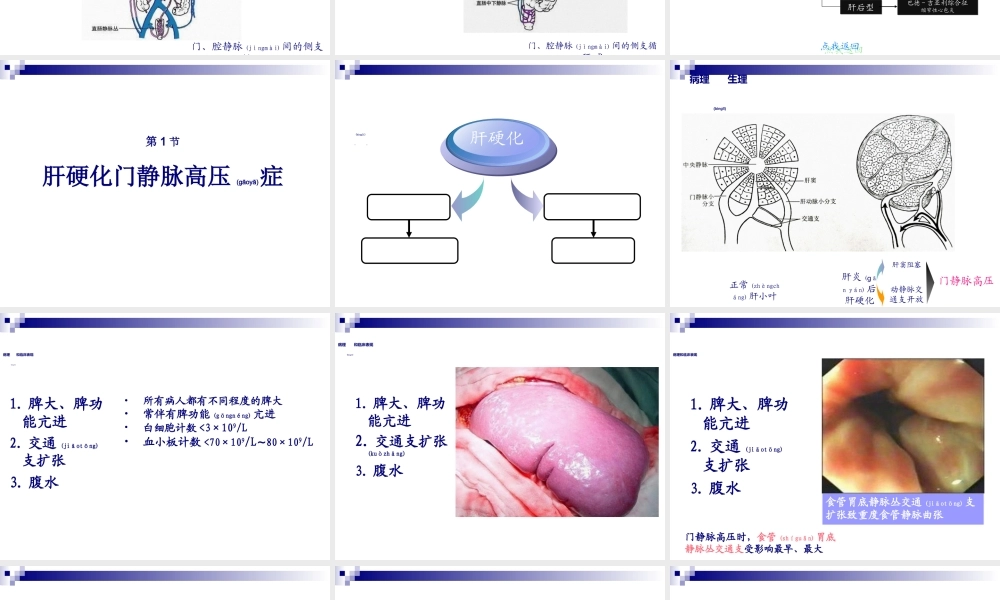 2022年医学专题—48第48章门静脉高压症(陈孝平)-56页PPT资料(1).ppt