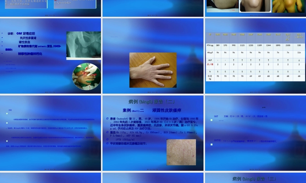 2022年医学专题—6-血液灌流典型病例分享---杨琴(1).ppt